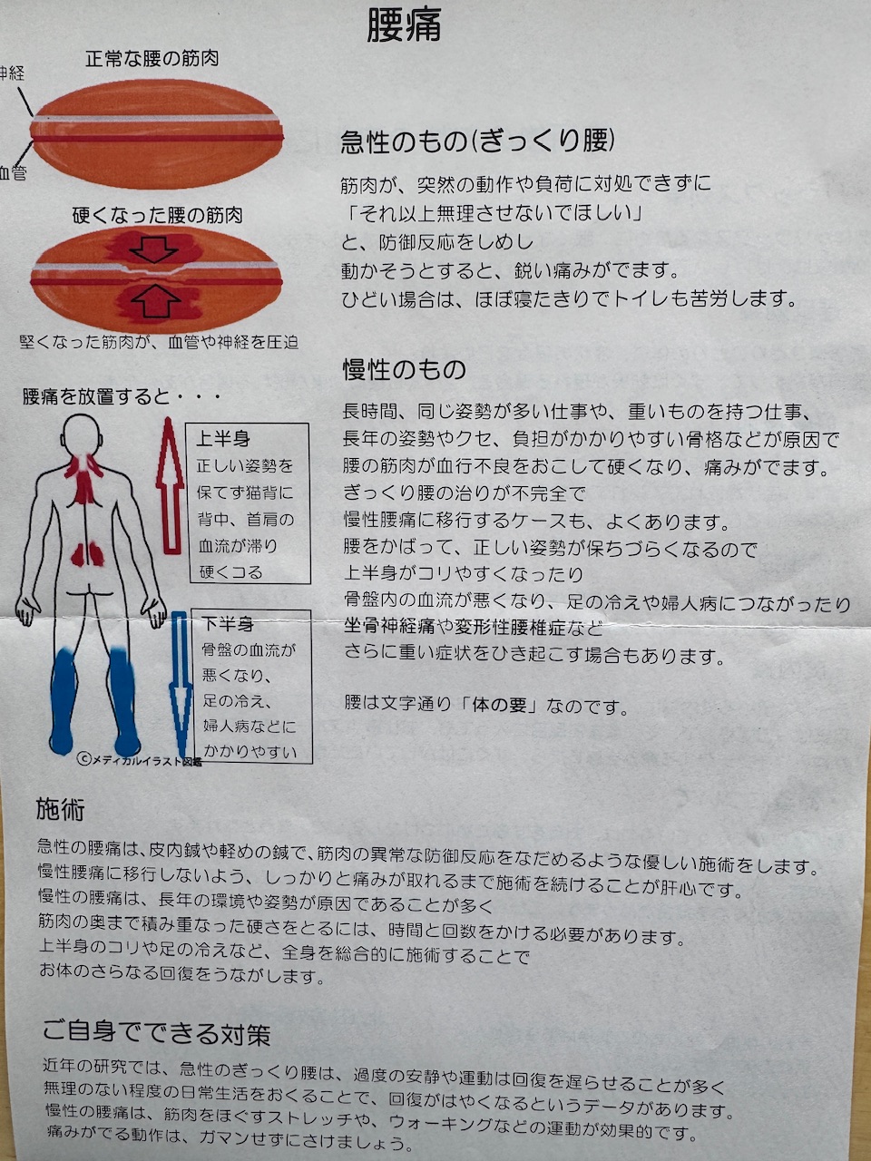 腰痛の仕組み（北田鍼灸院）